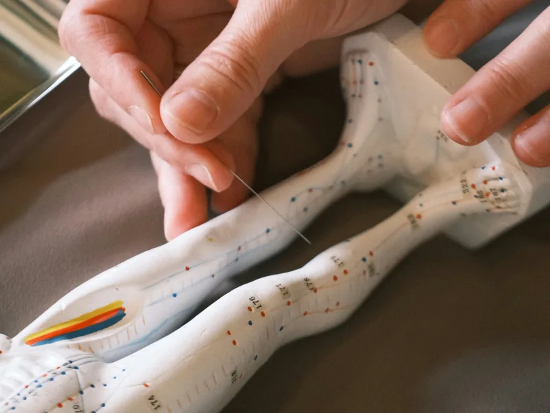 Acupuncture at Heights Chiropractic Center in Houston