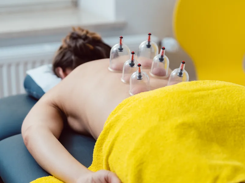 Cupping Therapy at Heights Chiropractic Center in Houston