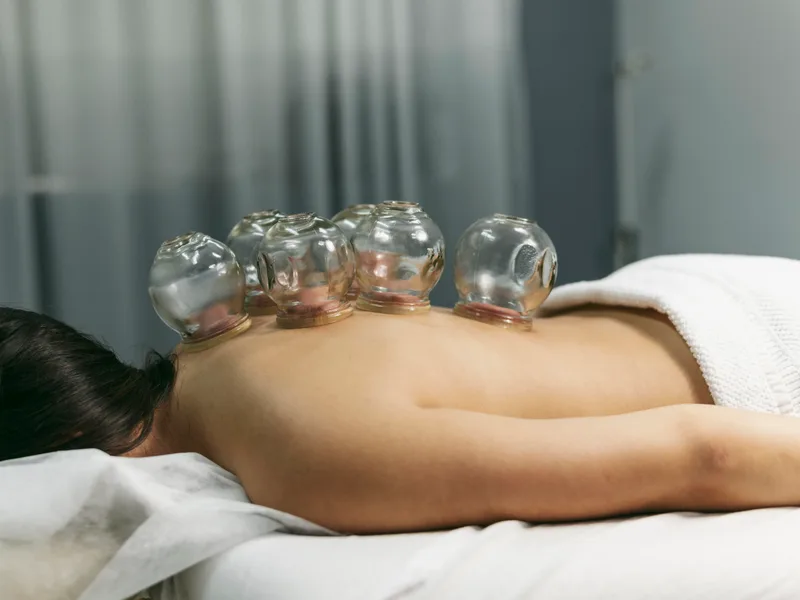 Cupping Therapy at Heights Chiropractic Center in Houston