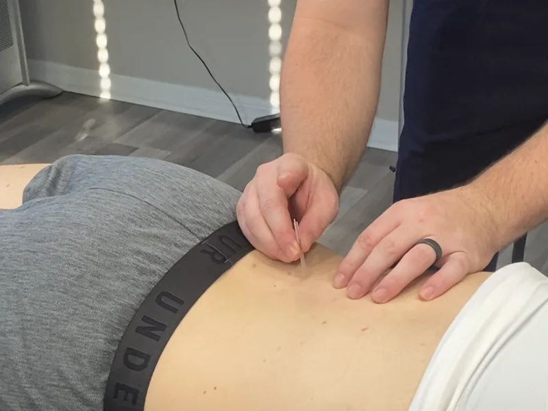 How Dry Needling works at Heights Chiropractic Center