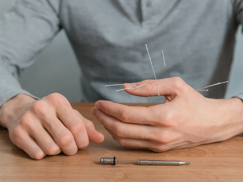 Dry Needling at Heights Chiropractic Center in Houston