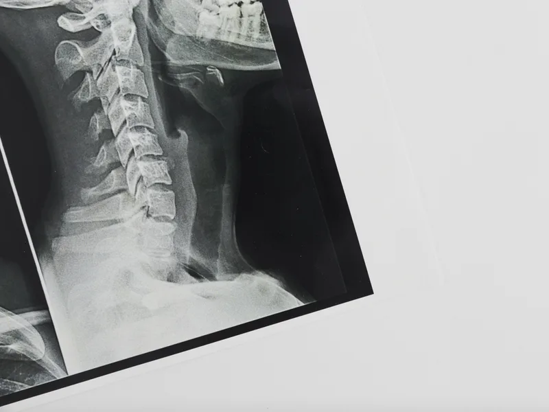 X-Rays at Heights Chiropractic Center in Houston