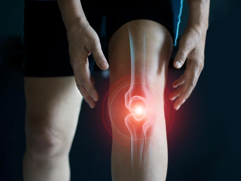 How Heights Chiropractic Center treats arthritis in Houston